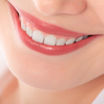 Smile Makeover Treatment in Wimbledon