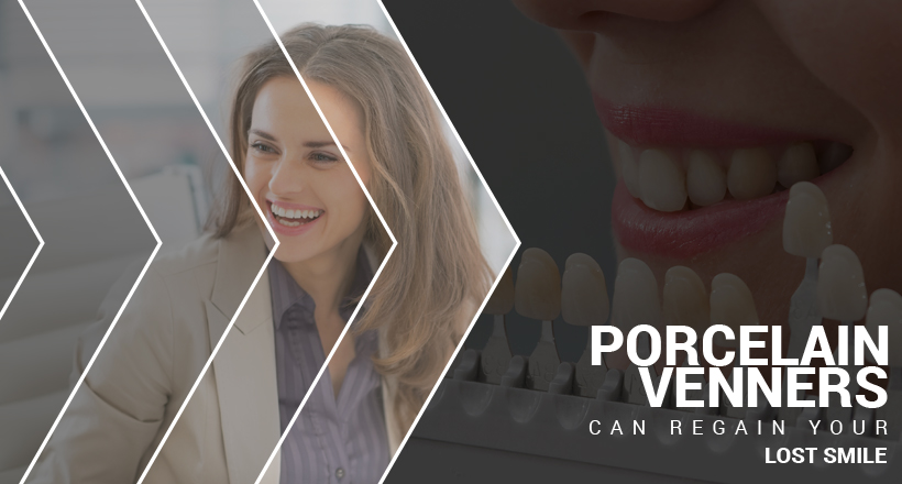 https://www.sw19confidental.co.uk/wp-content/uploads/2021/08/bring-back-the-lost-charm-to-your-smile-with-porcelain-veneers.jpg