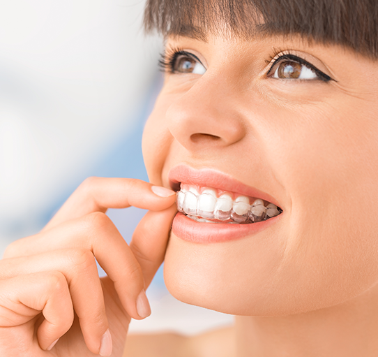 Invisalign dentist in Wimbledon
